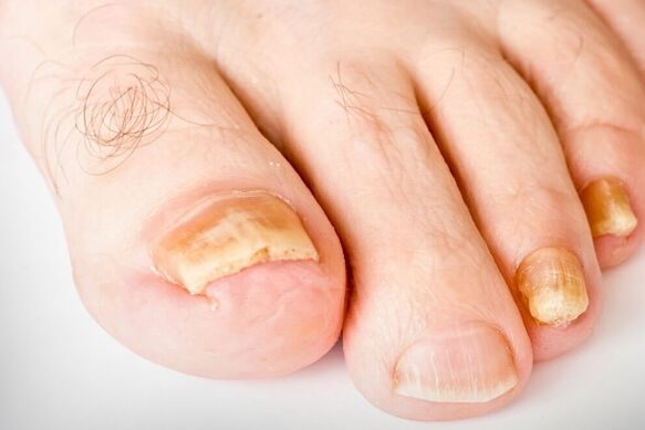 La terza fase del Nagelhirb
