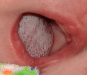 Localizzazione della malattia con un fungo