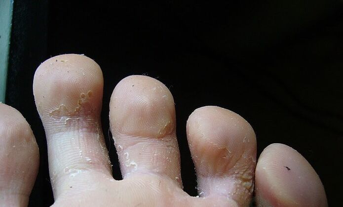 Stadio iniziale del fungo